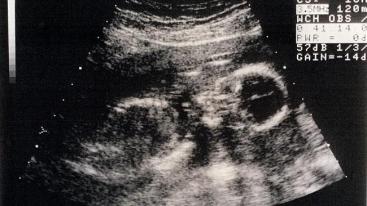 417592-8b82b764-6d5e-11e5-a21c-437ddd761843